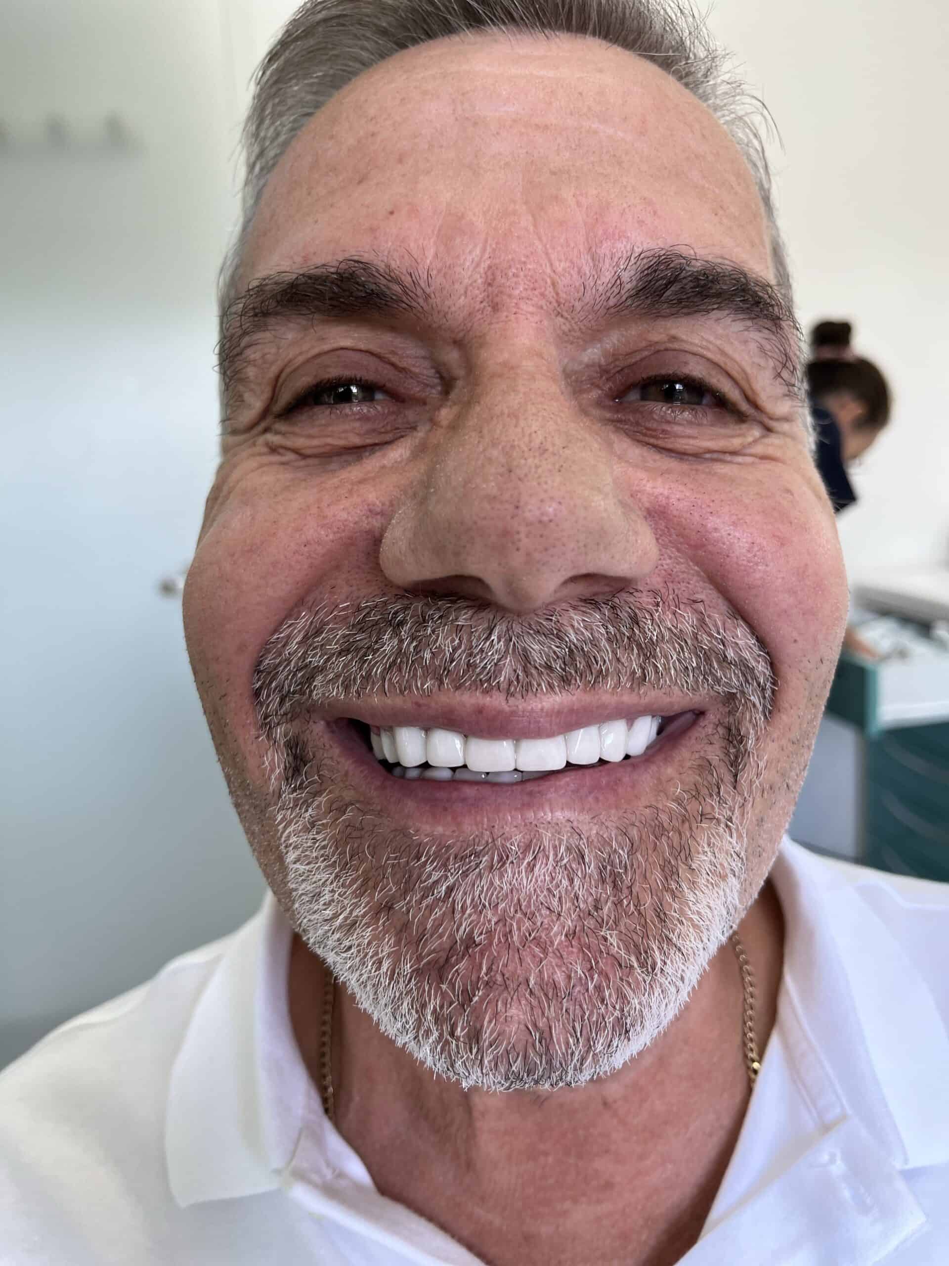 Smile makeover with healthy, white teeth at the dental clinic.