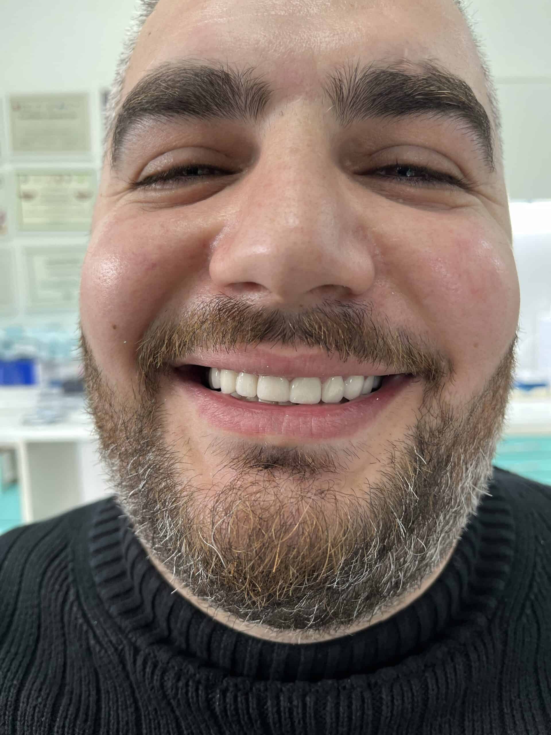 Close-up of a smiling man showing healthy teeth at Vendeveloper dental clinic.
