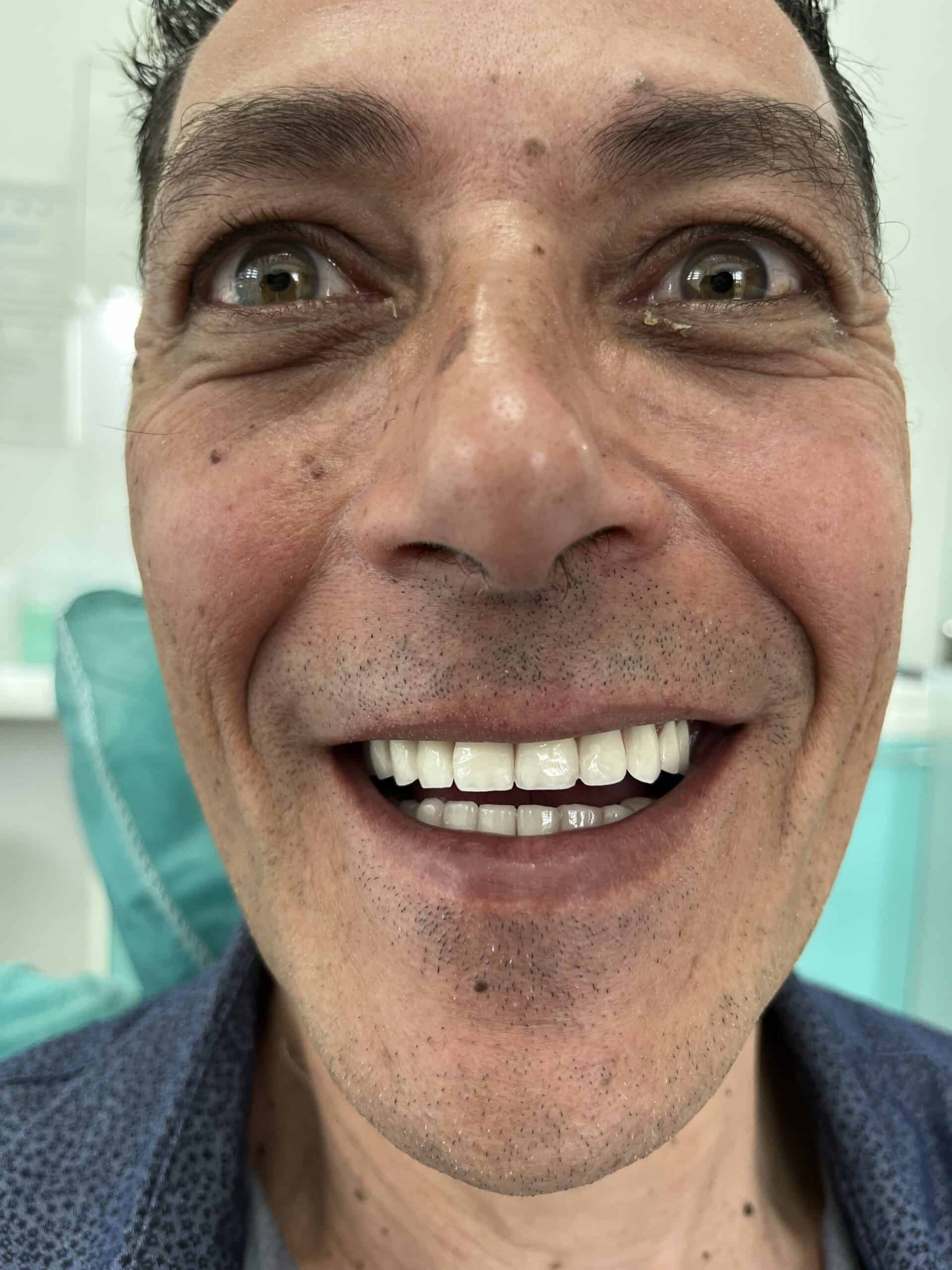 Smile with healthy teeth and gums at Vendeveloper Dental Clinic.