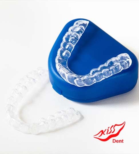 clear aligners nuvola in Albania
