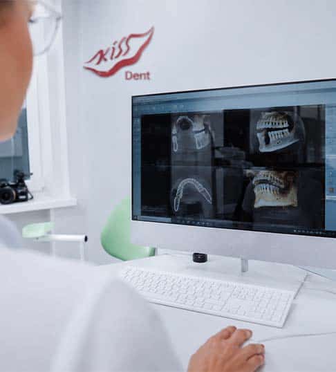 dental x rays in Albania