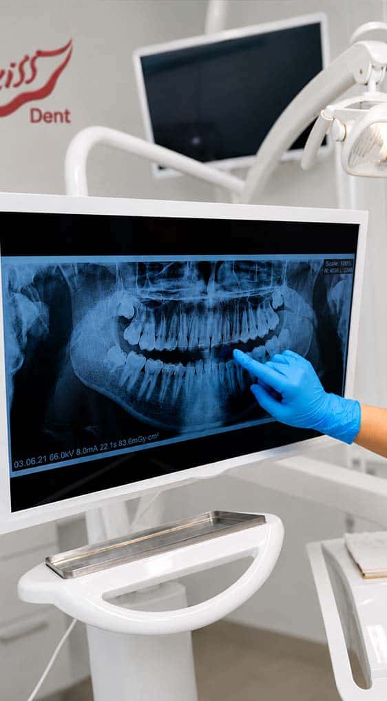 dental x rays in tirana