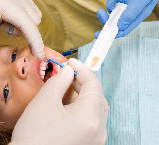 fluoride treatment in Albania