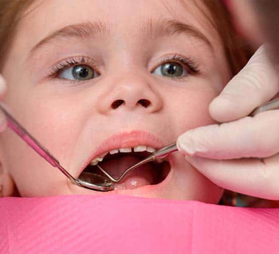 otturazione dentale per bambini in Albania