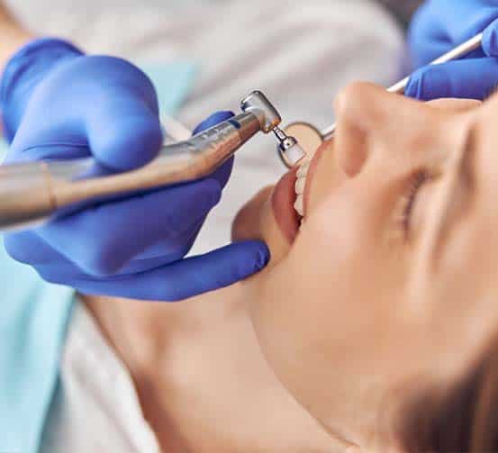 pulizia dentale professionale in Albania